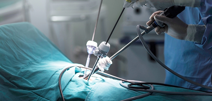 Paediatric Laparoscopy